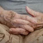 Demência em idosos hospitalizados não é percebida em até 50% dos casos