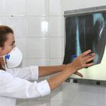 Planalto Norte teve mais de 400 casos de tuberculose registrados nos últimos 10 anos