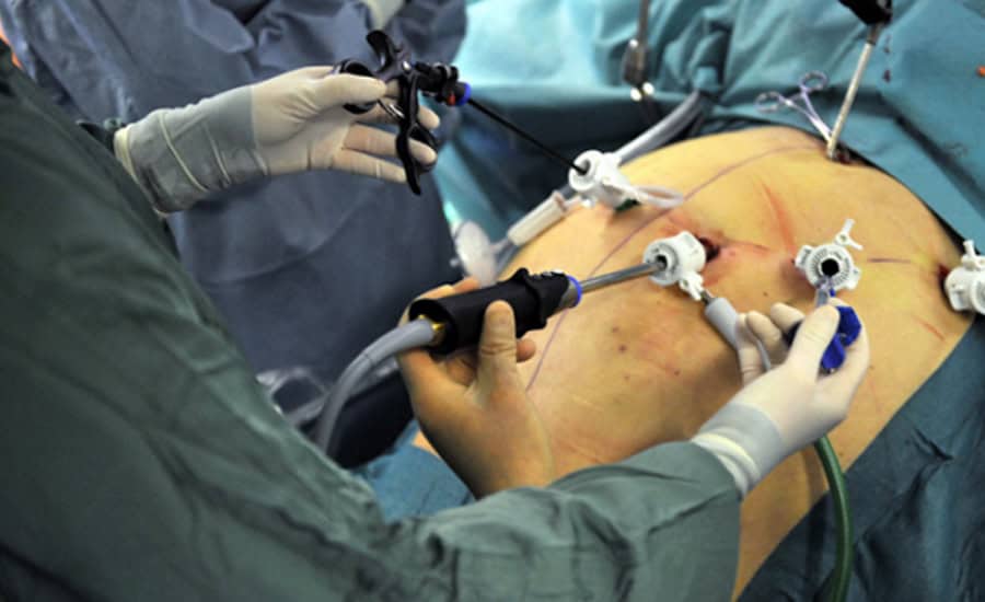 Santa Catarina aumenta em mais de 500% as cirurgias bariátricas na rede pública de saúde